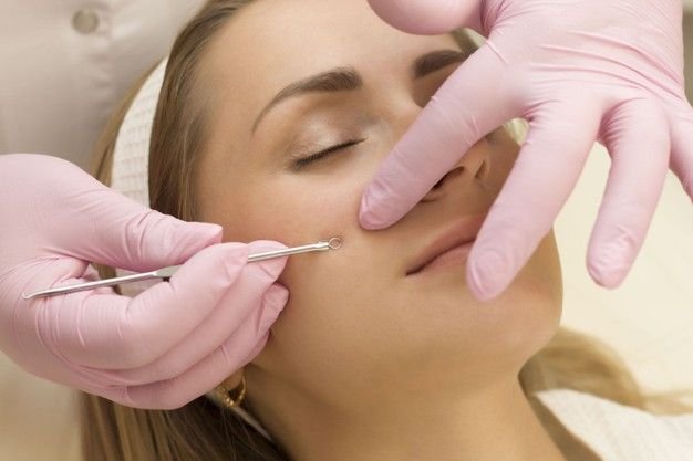 face cleanup in karaikudi